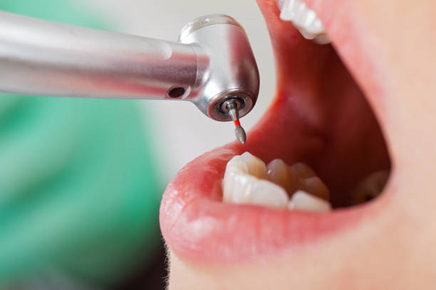 Best Dentist for Tooth Abscess  in Stirling, NJ